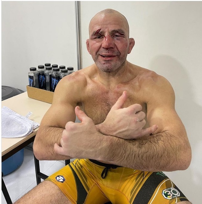 Гловер Тейшейра не получил серьезных травм, проиграв Джамахалу Хиллу на UFC 283