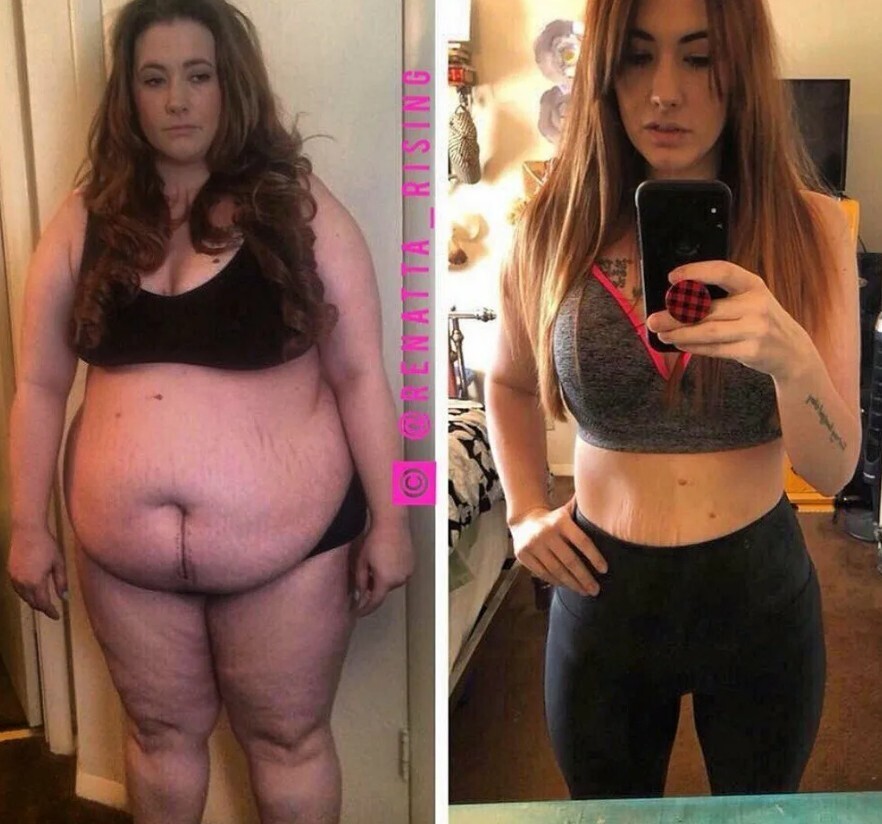 Напиток, благодаря которому лишний вес сбежит от вас без оглядки! Очень простое и эффективное средство