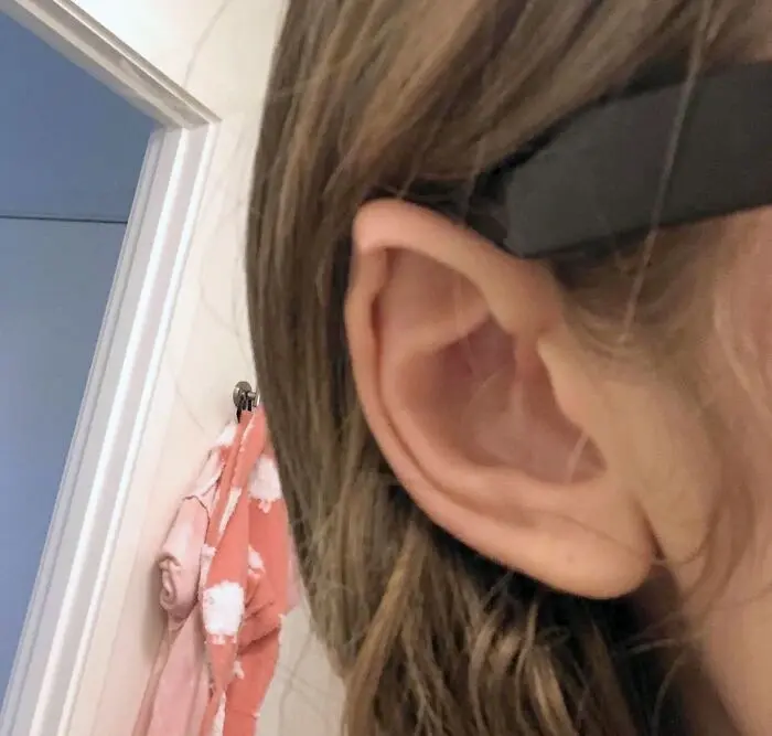 ТОП Фотографии необычных людей доказывающие, что генетику трудно игнорировать.