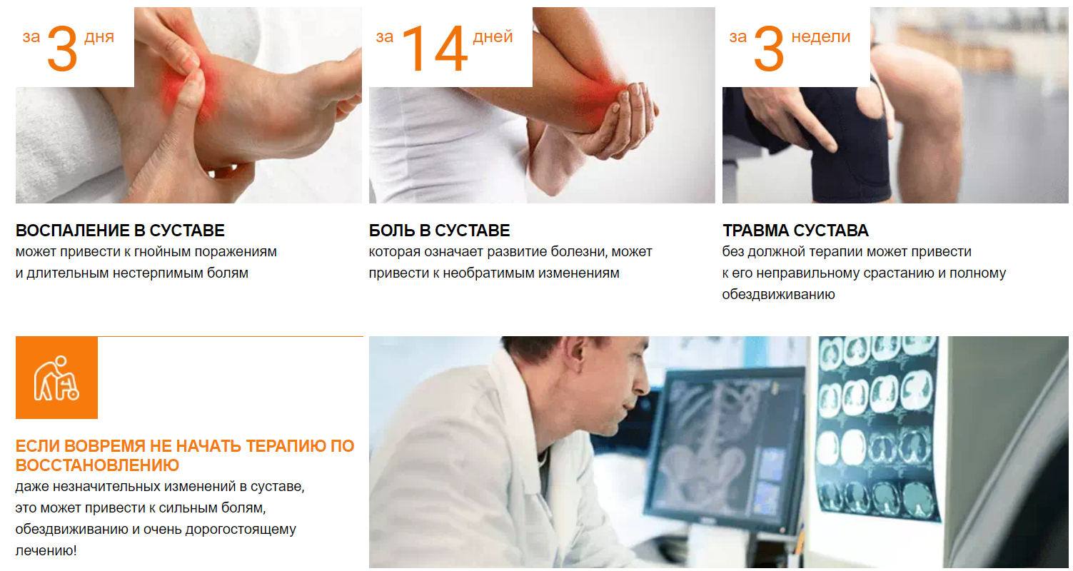 О суставах и БОЛИ | ТОП