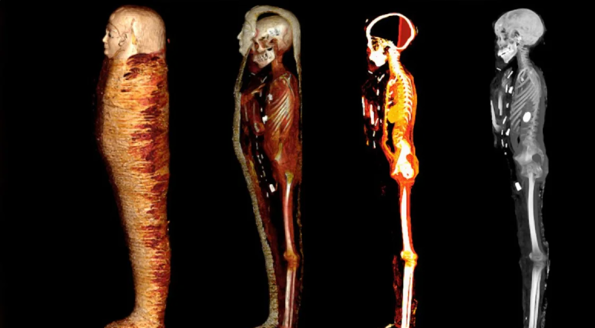 Мумия «Золотого мальчика» распакована в цифровом виде через 2300 лет, раскрыты секреты