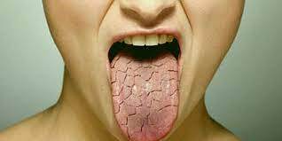 Расторопша для печени и многое другое. Преимущества и противопоказания