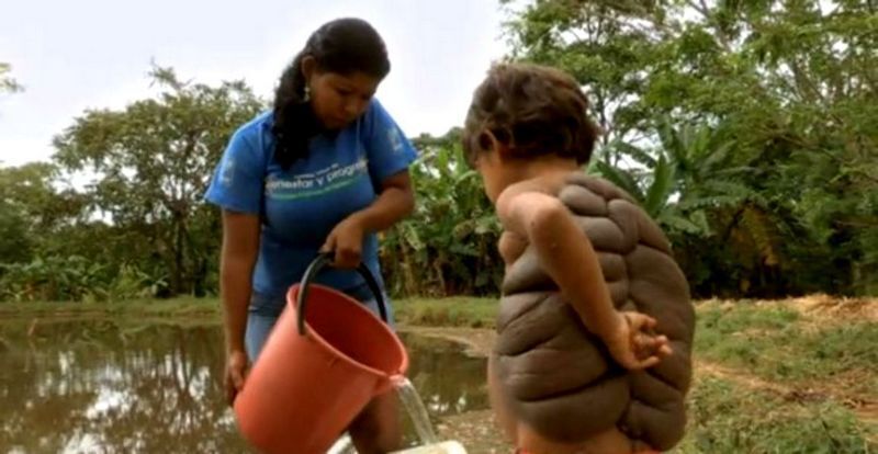 Люди с лишними частями тела.