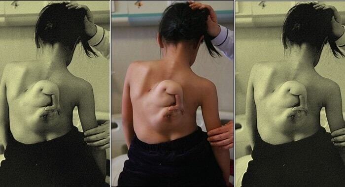 Люди с лишними частями тела.