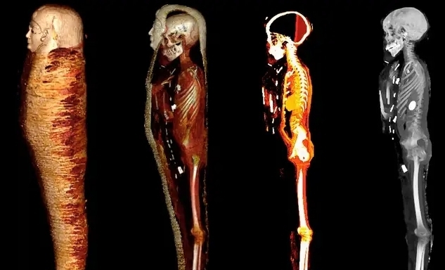 Цифровое сканирование раскрывает интимные подробности о мумии 2300-летней давности