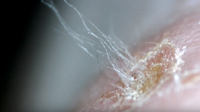 Противогрибковые препараты для обработки обуви | Дезинфекция обуви от грибка