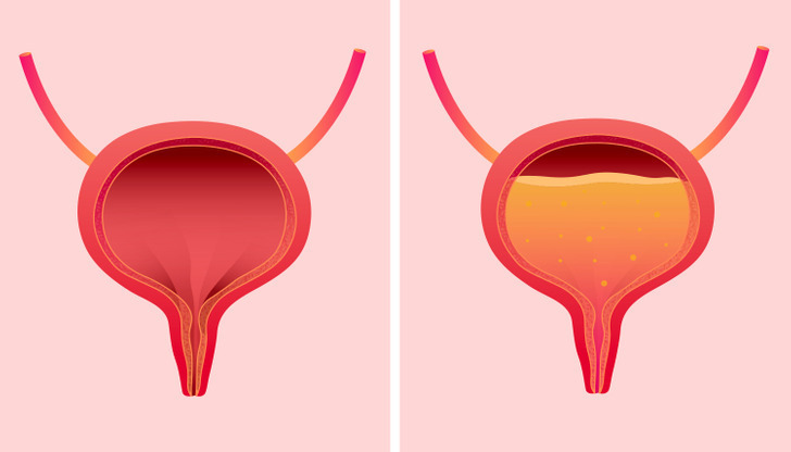 Почему нельзя сдерживать мочу