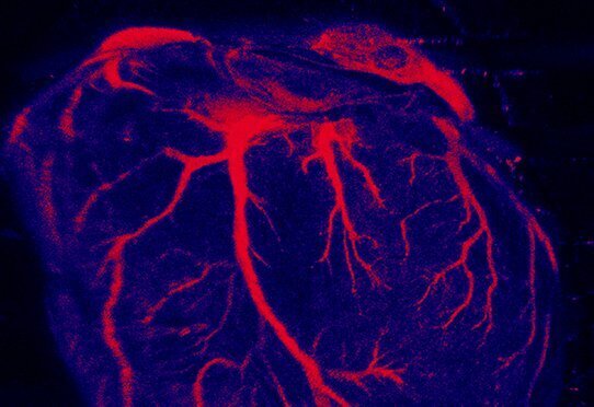 Простой анализ крови для предотвращения внезапной смерти.
