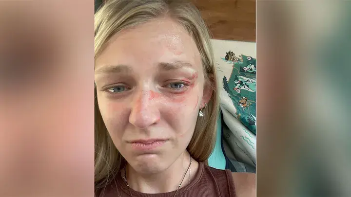 Обновление Габби Петито: недавно выпущенная фотография в высоком разрешении показывает травмы во время внутреннего звонка в Юте