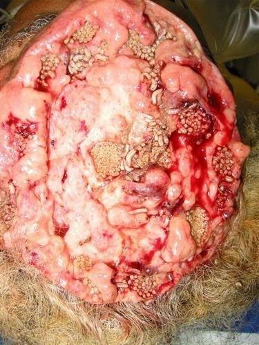 Страшный и ужасный па-ра-зит!