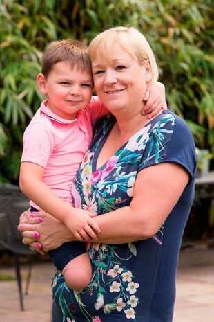 Ребёнку пришлось ампутировать ноги из-за жестокого обращения матери.