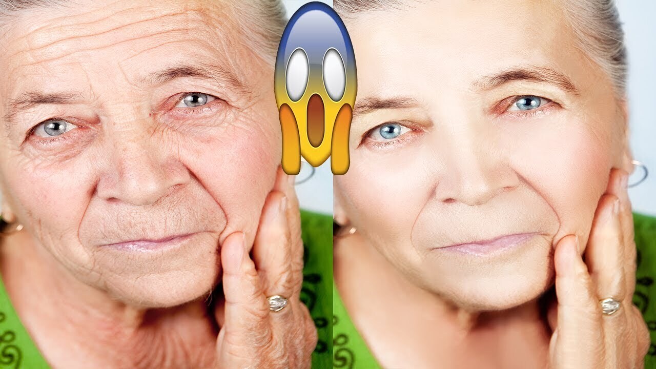 По какой причине появляются морщины?