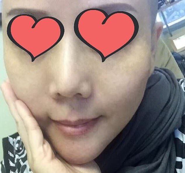 "Пластическая операция прошла неудачно: женщина госпитализирована с сильными ожогами после косметической процедуры в Тайваньской клинике"