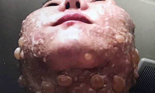 "Пластическая операция прошла неудачно: женщина госпитализирована с сильными ожогами после косметической процедуры в Тайваньской клинике"