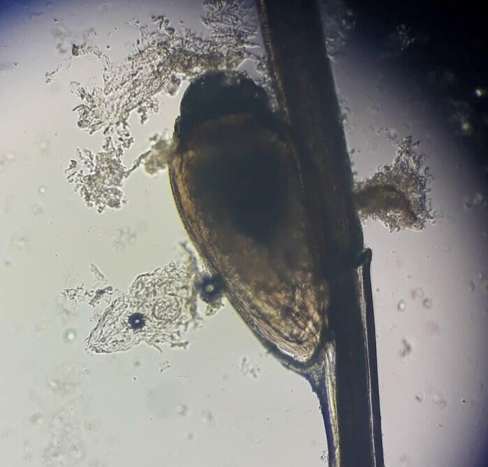 Паразиты гнездятся в подмышках человека 2 месяца