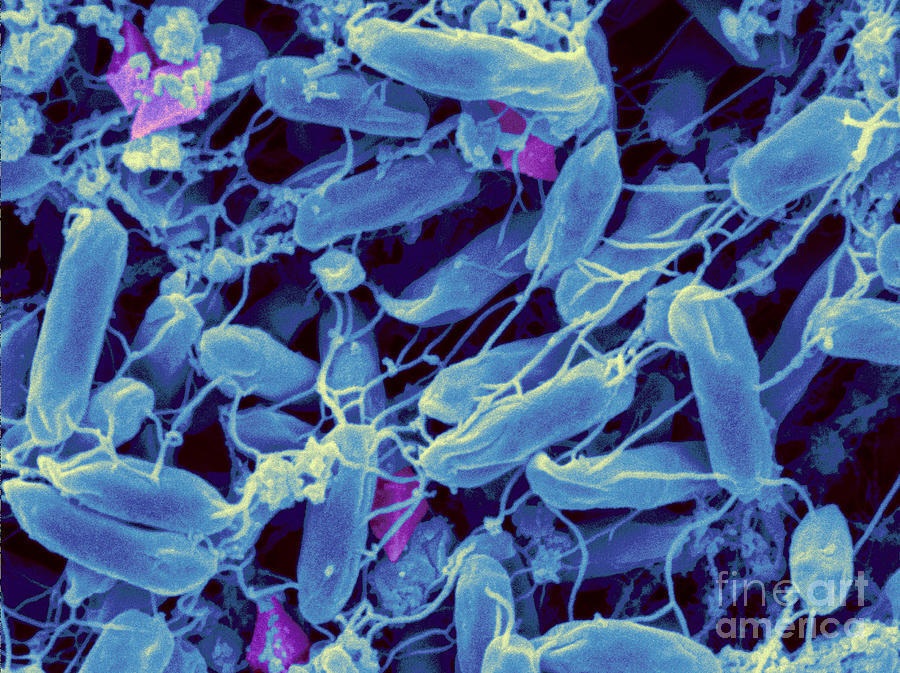 В озёрах Киву нашли бактерии,которые пожирают металл!