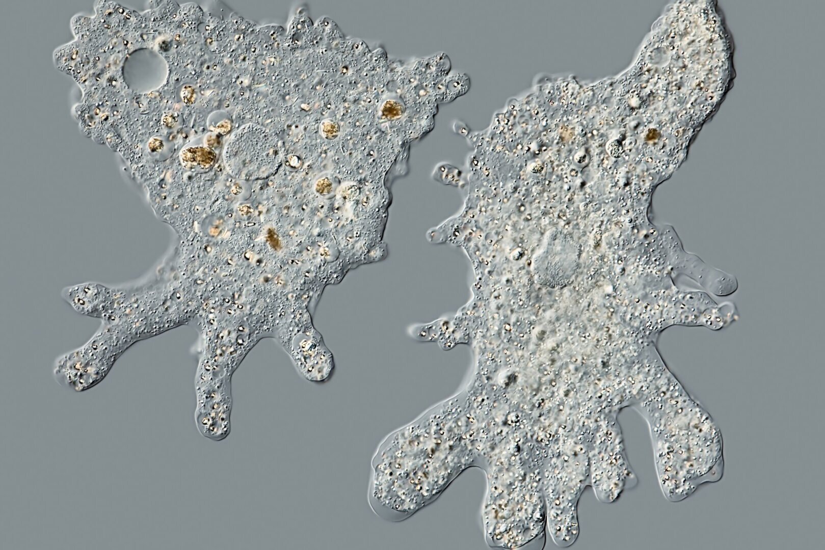 Глобальное потепление может привести к распространению амебы, повреждающей мозг!!!