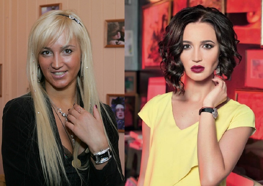 Почему многие люди решаются на пластические операции?