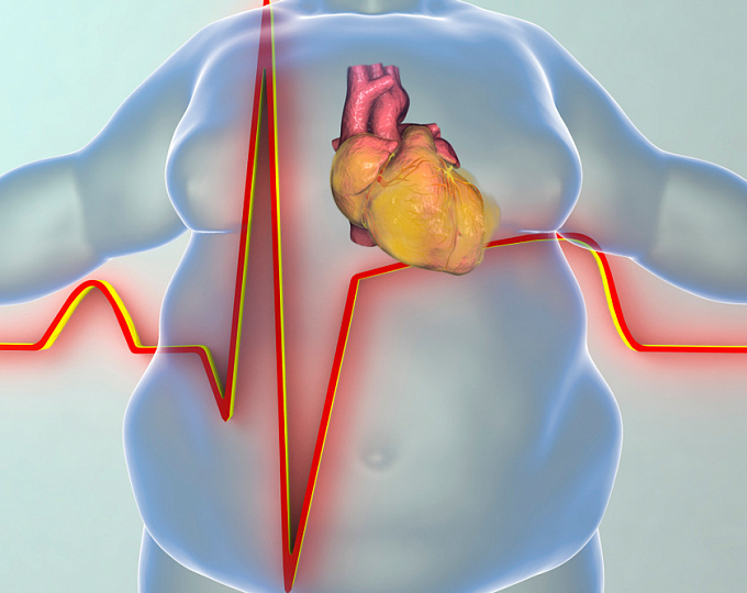 Ожирение / полнота / избыточный вес!!!