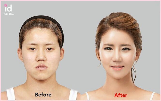 Почему многие люди решаются на пластические операции?