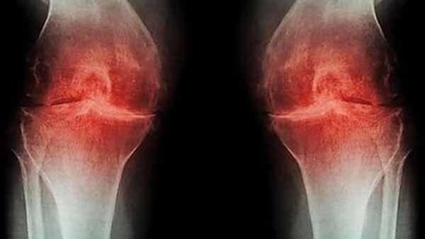 Как этот пластырь на колено устраняет мою постоянную, пульсирующую боль в колене, крадя мою независимость, свободу и уверенность в себе - НАВСЕГДА!