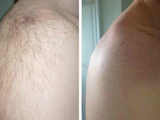 Ревалюционный спрей для удаления волос