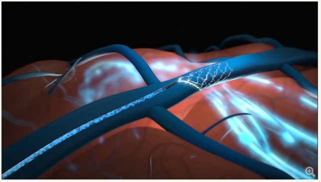 Американские регуляторы отклонили предложение Элона Маска о тестировании мозговых чипов на людях, сославшись на риски безопасности