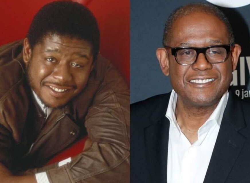 Лицо со шрамом: Знаменитости с дефектами внешности