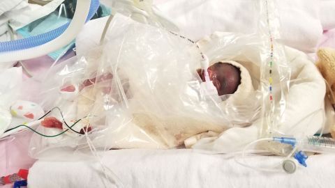 Канадские братья и сестры, родившиеся на четыре месяца раньше срока, установили рекорд как самые недоношенные близнецы в мире