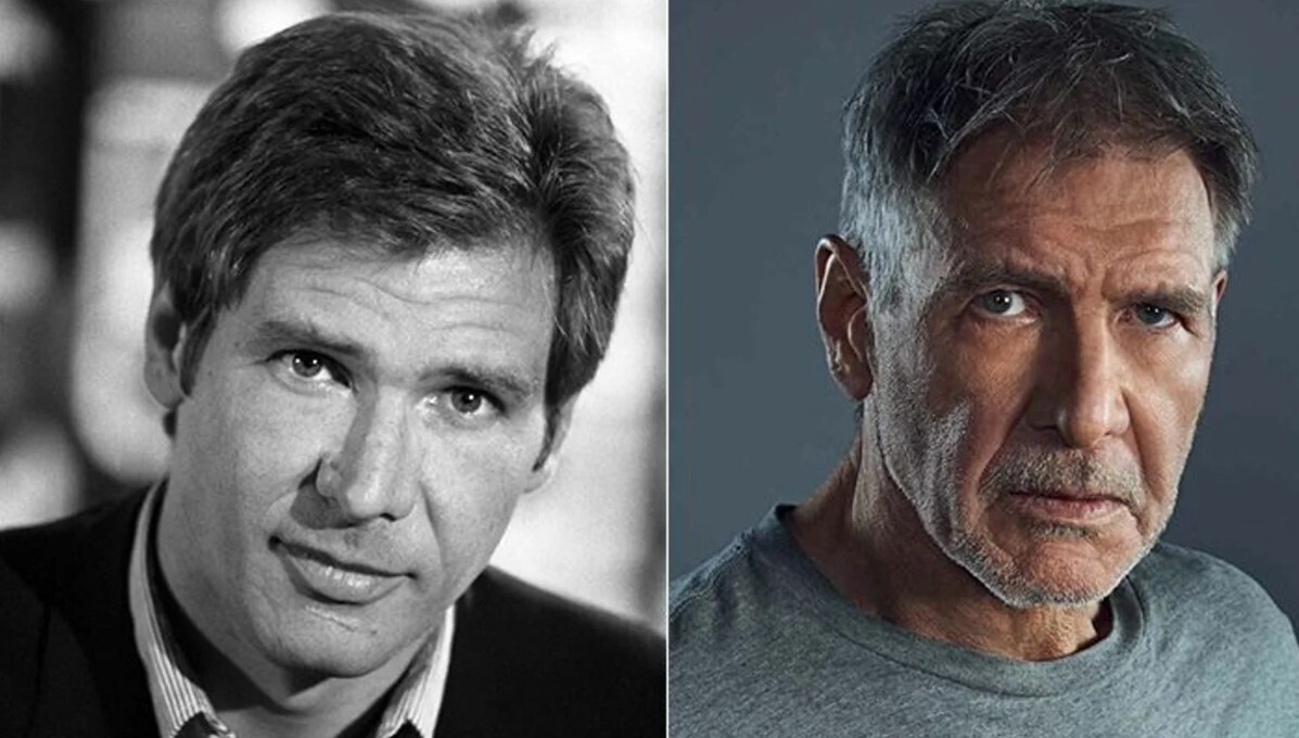 Лицо со шрамом: Знаменитости с дефектами внешности