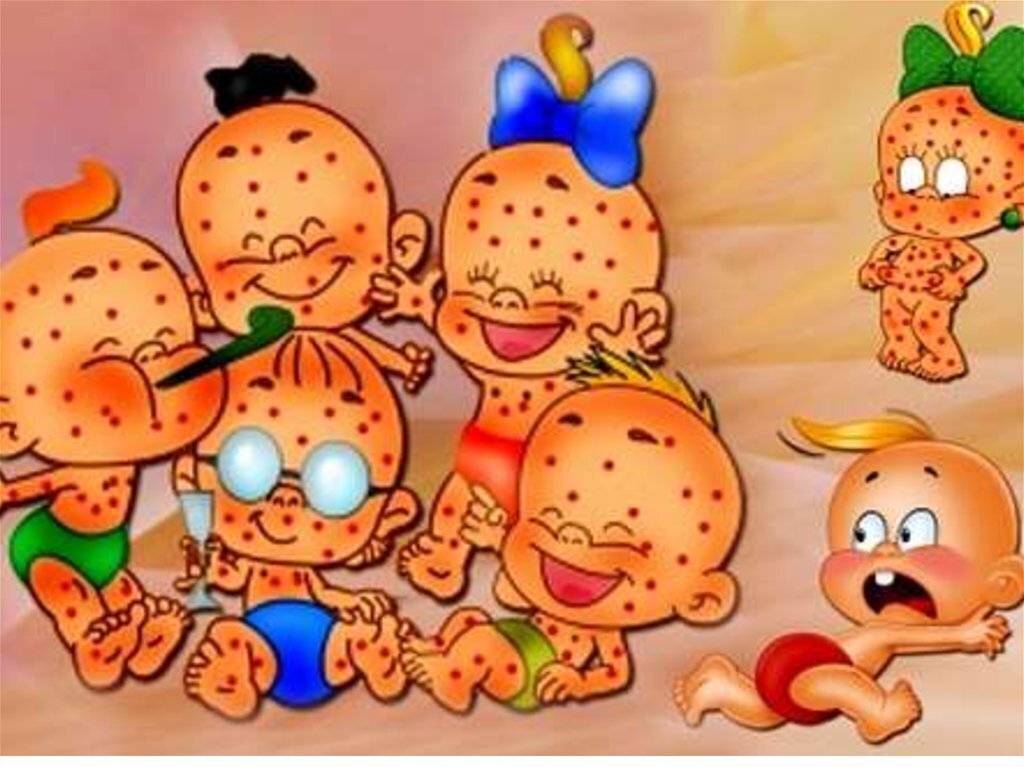 В России пропала вакцина против ветрянки.