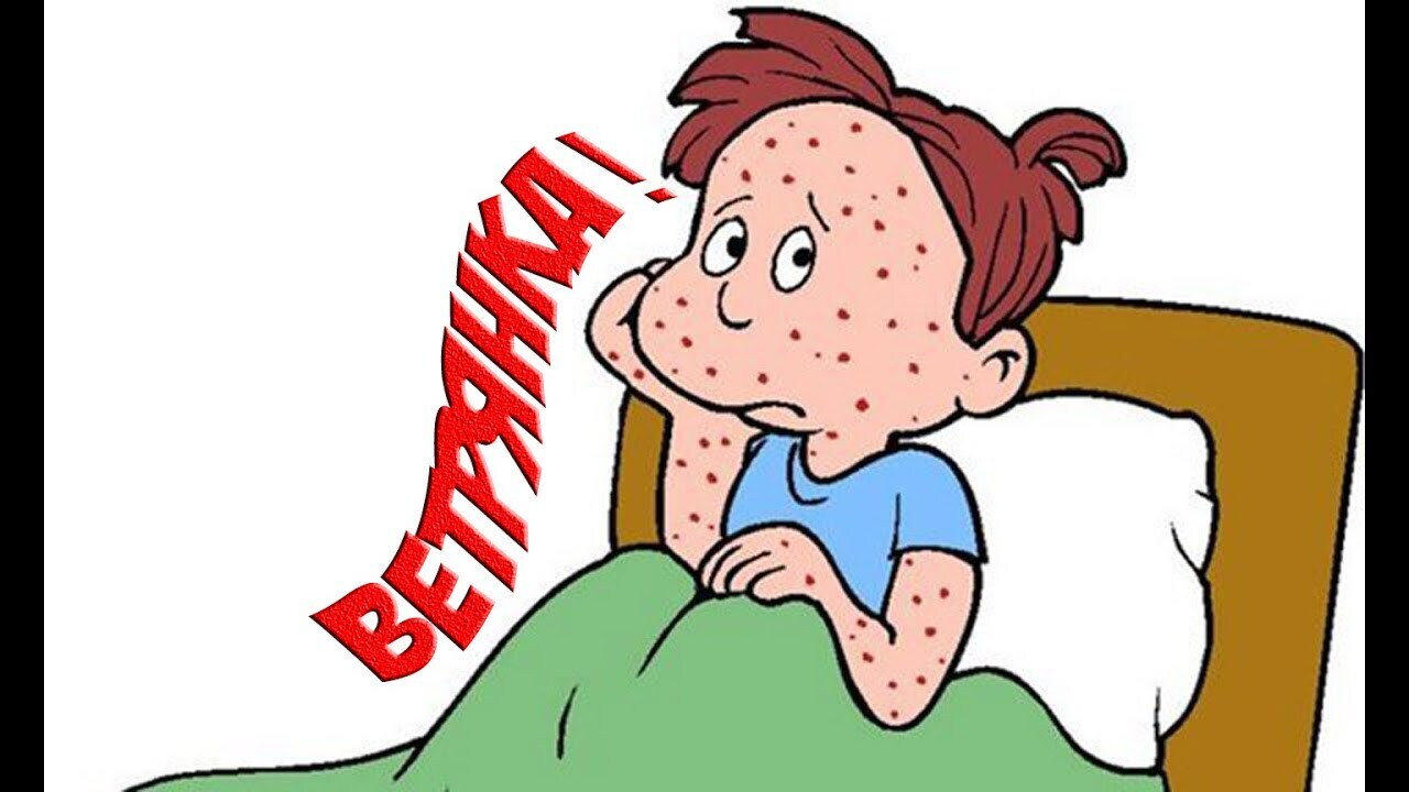 В России пропала вакцина против ветрянки.