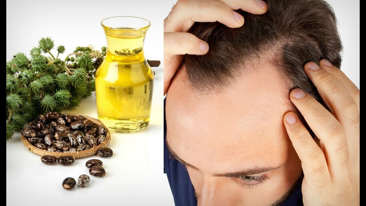 Домашние средства от выпадения волос у мужчин