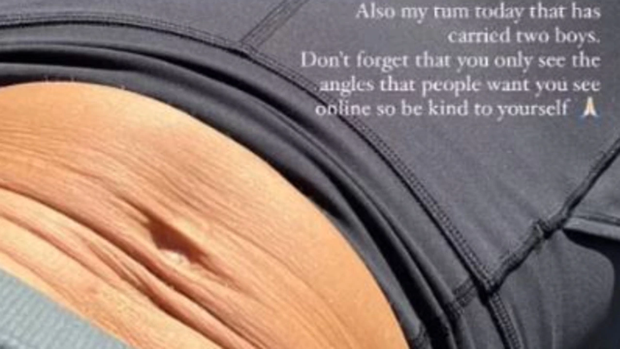 Откровенный снимок живота модели стал вирусным по очень удручающей причине