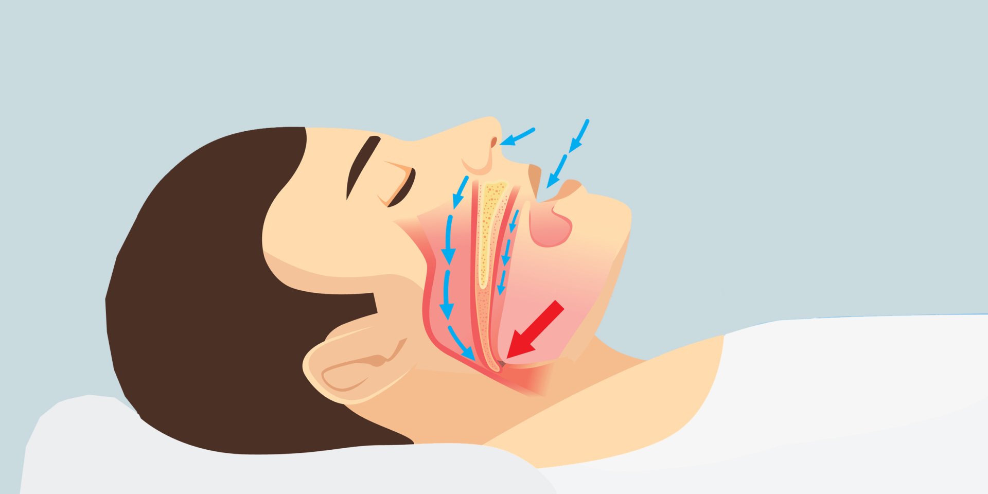 Самые распространенные причины, по которым люди храпят