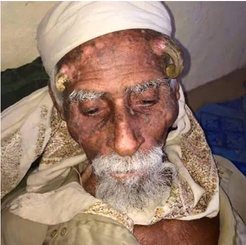 Скончался 140- летний мужчина с рогами