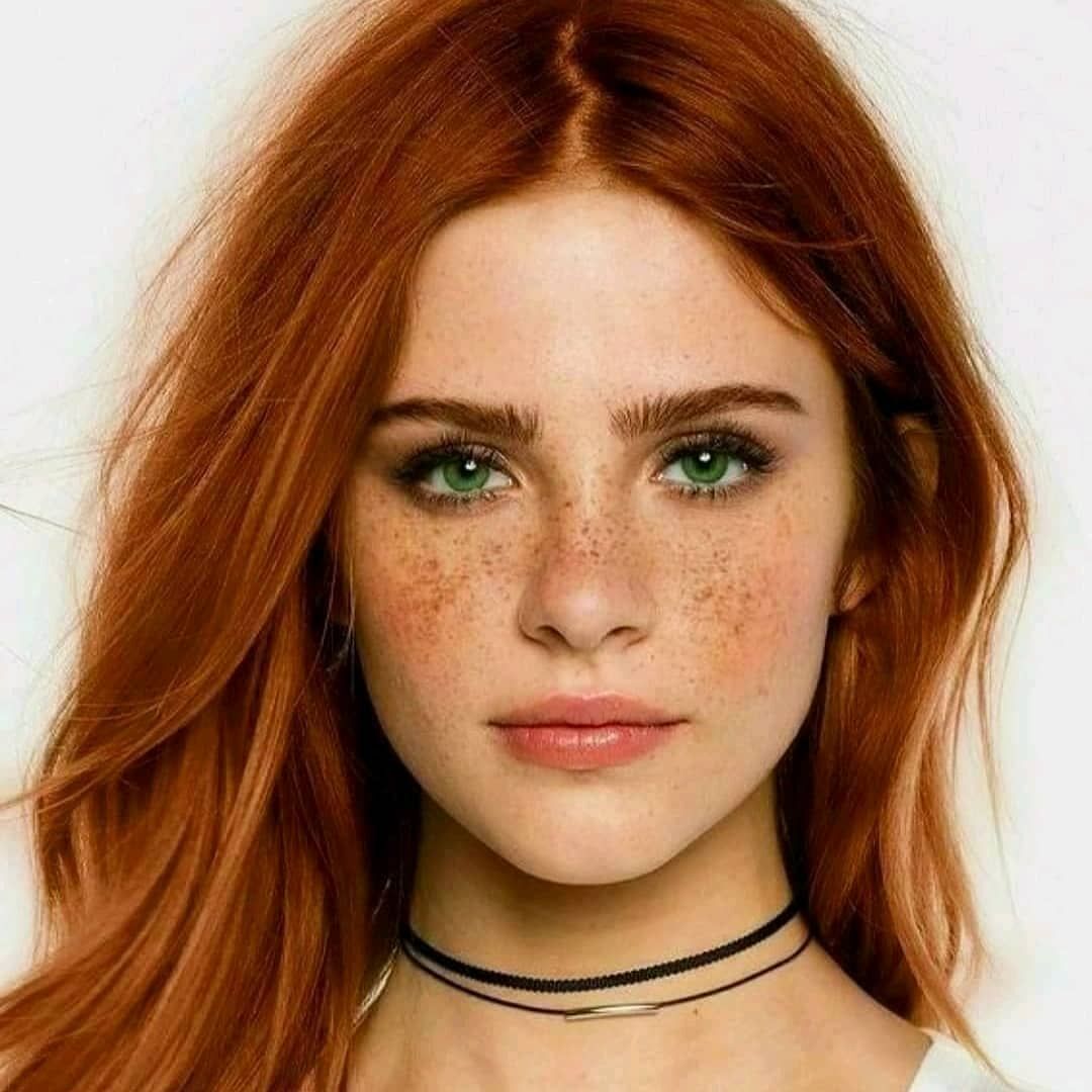 Как избавиться от веснушек