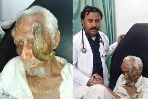 Скончался 140- летний мужчина с рогами