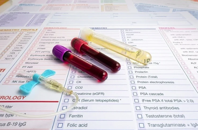 Биомаркеры, которые могут предсказать длительные симптомы COVID