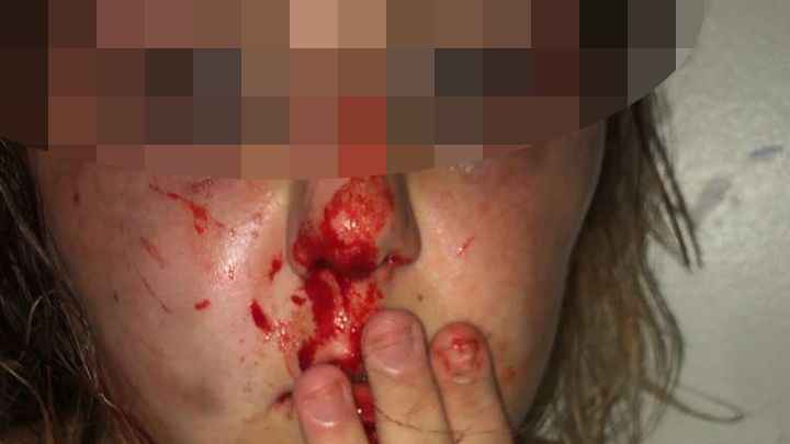 Трое девочек-подростков в Австралии обвинили после того, как они заманили «друга» на фальшивую вечеринку, а затем якобы пытали ее часами