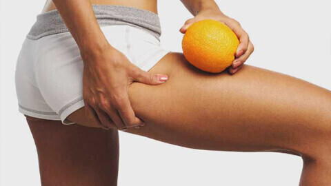 Целлюлит. Избавиться навсегда - реально!