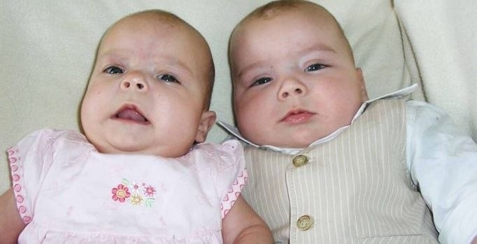 Редкий диагноз сначала заболел мальчик, а за ним слегла и сестра....врачи в шоке.