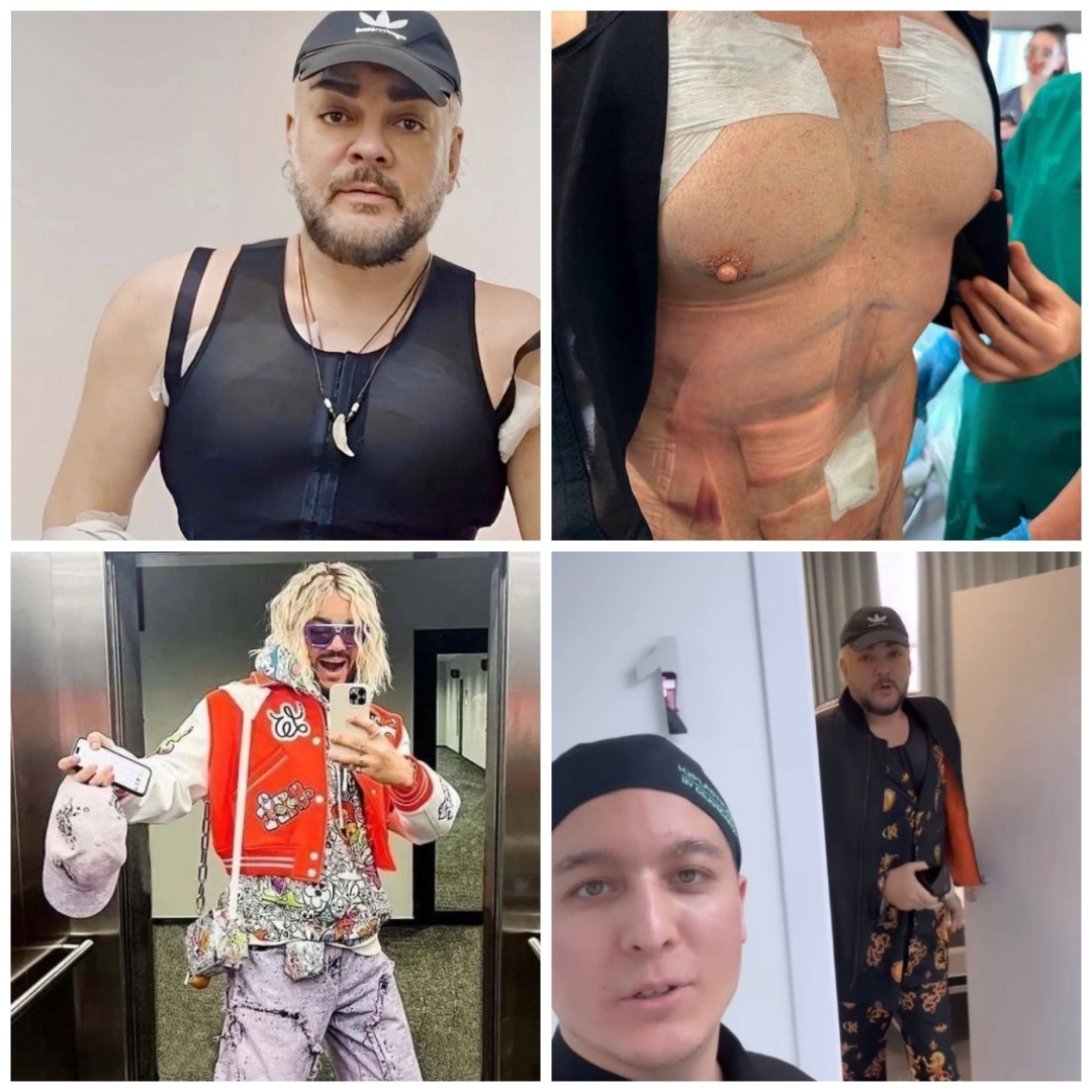 Король попа - трансформер. Киркоров затеял плотно преобразиться.