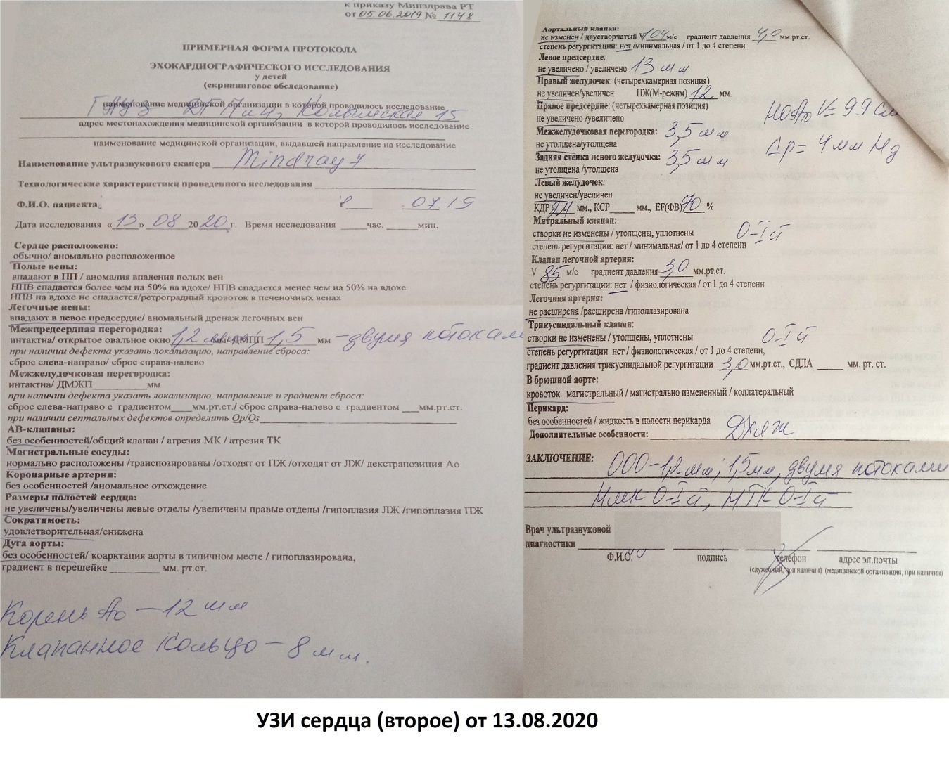 Врожденный порок сердца. От диагноза до операции!