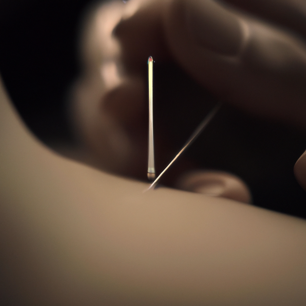 Иглотерапия: Искусство Лечения