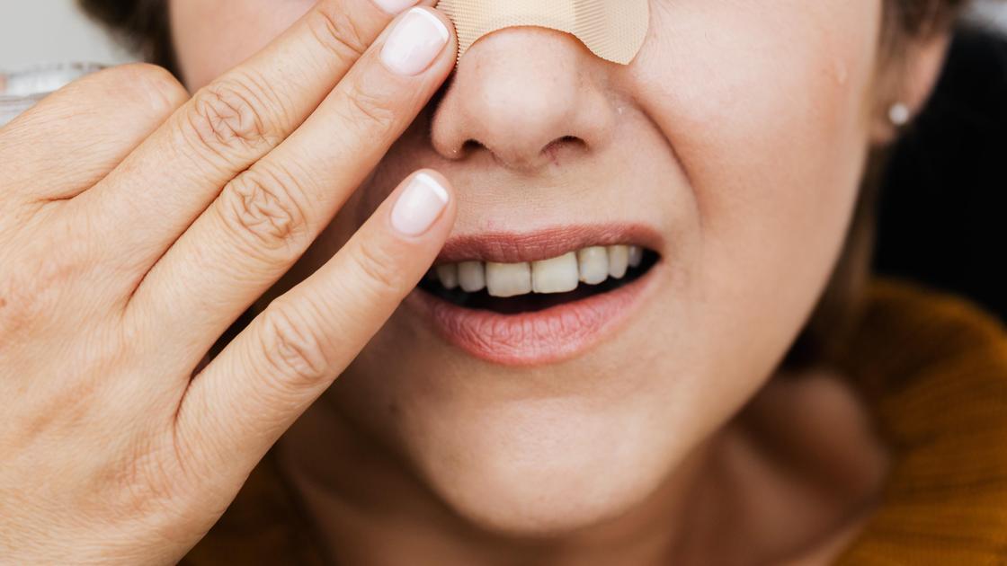 Укус вампира: Как ролевая игра в Петербурге оставила девушку без куска носа!