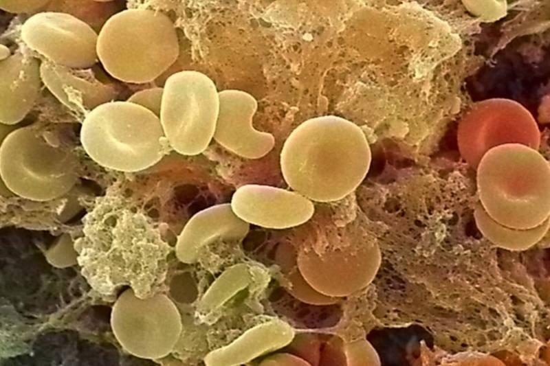 Что может рассказать о вас ваша группа крови.