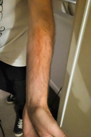 Охотники за привидениями призывают женщину покинуть «дом с привидениями» после «демонических царапин» при экзорцизме