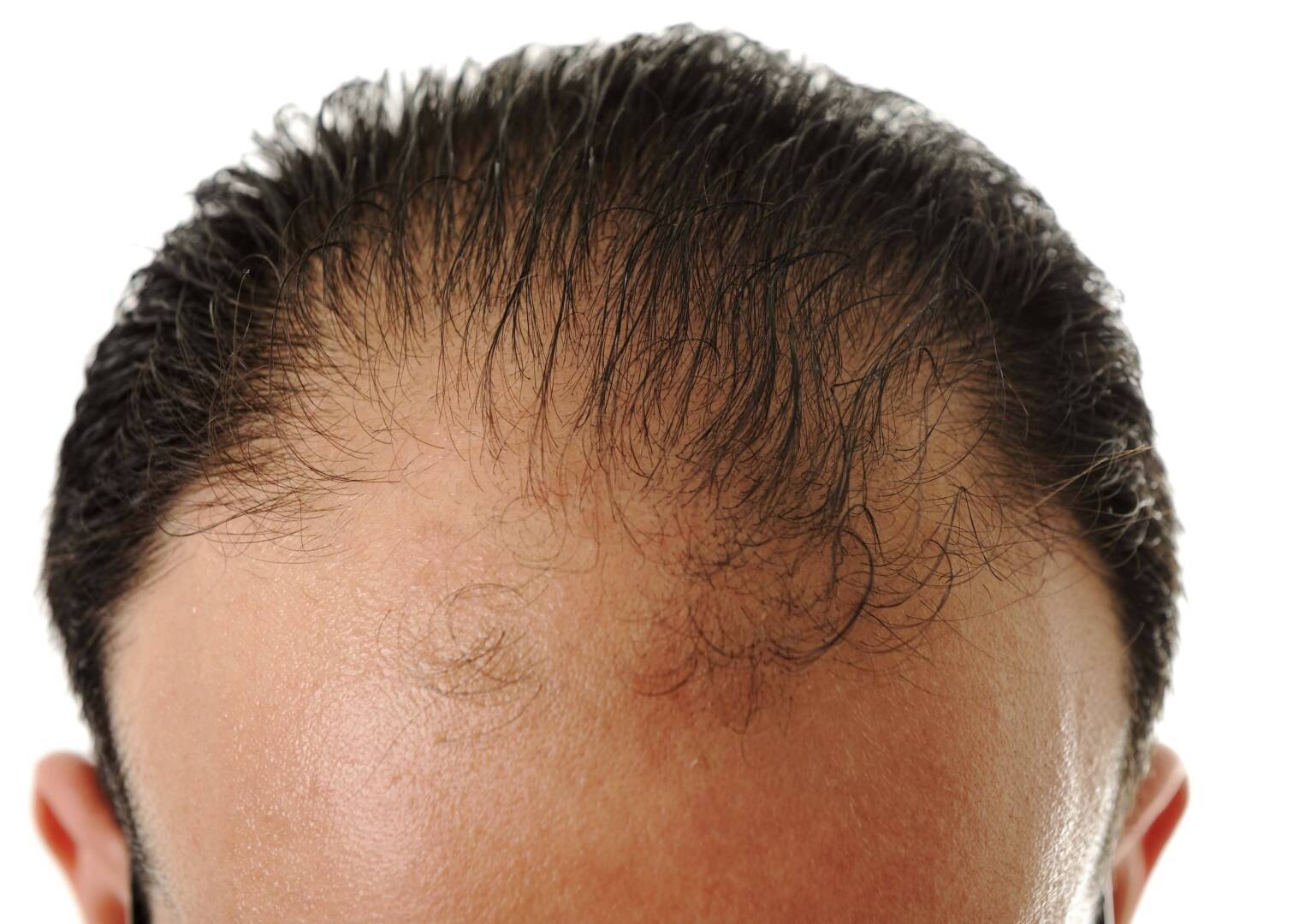 Искусство грациозно лысеть