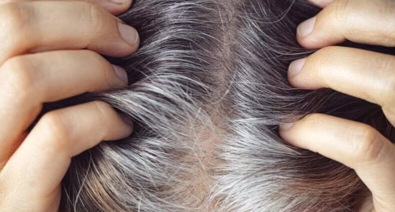 Наука разгадывает тайны механизма, вызывающего поседение волос